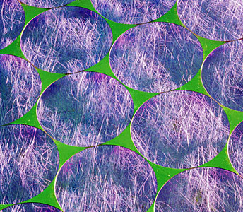 Membrane